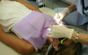 Root Canal Treatment Cost in Sacramento,  CA