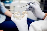 Affordable Dental Implant Sacramento